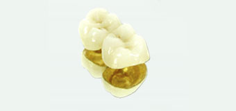 gold dental crowns