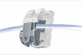 speed braces