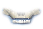 long dental implants