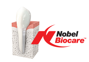 nobel biocare bangkok dental