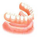 bangkok dentures